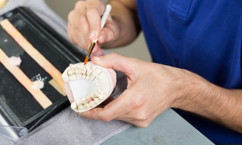 Closeup of a dental technician applying porcelain to a dentition mold in a lab